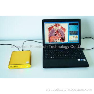 OEM Golden Computer System 3D NLS Sub Health Analyzer For B